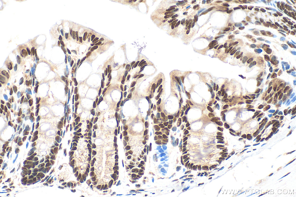 Immunohistochemistry (IHC) staining of mouse colon tissue using Sam68 Polyclonal antibody (10222-1-AP)