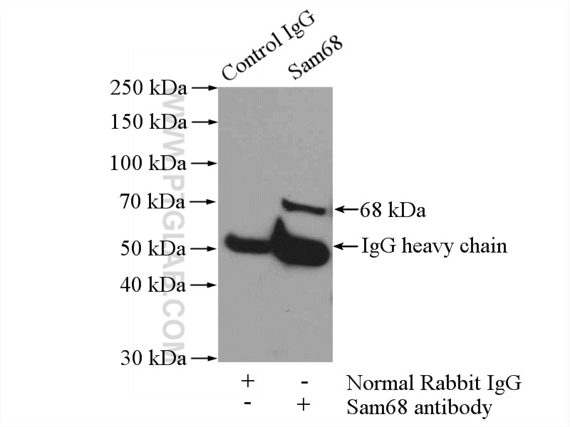 Immunoprecipitation (IP) experiment of HeLa cells using Sam68 Polyclonal antibody (10222-1-AP)