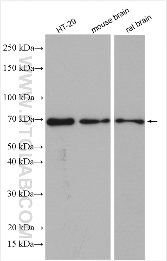 Western Blot (WB) analysis of various lysates using Sam68 Polyclonal antibody (10222-1-AP)