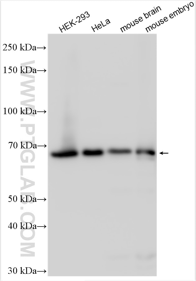 Western Blot (WB) analysis of various lysates using Sam68 Polyclonal antibody (10222-1-AP)