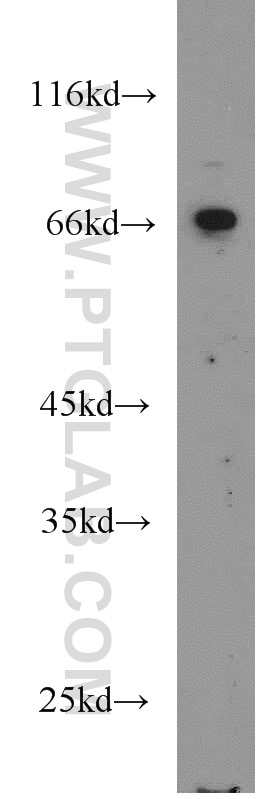 Western Blot (WB) analysis of mouse brain tissue using Sam68 Polyclonal antibody (10222-1-AP)