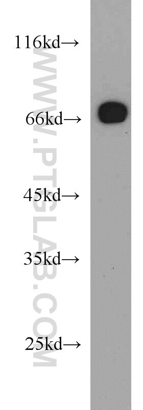 WB analysis of HeLa using 10222-1-AP