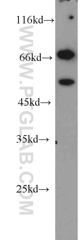 Western Blot (WB) analysis of NIH/3T3 cells using Sam68 Polyclonal antibody (10222-1-AP)