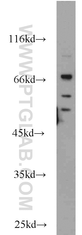 Western Blot (WB) analysis of HEK-293 cells using Sam68 Polyclonal antibody (10222-1-AP)
