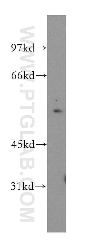 Western Blot (WB) analysis of A549 cells using KHDRBS3 Polyclonal antibody (13563-1-AP)