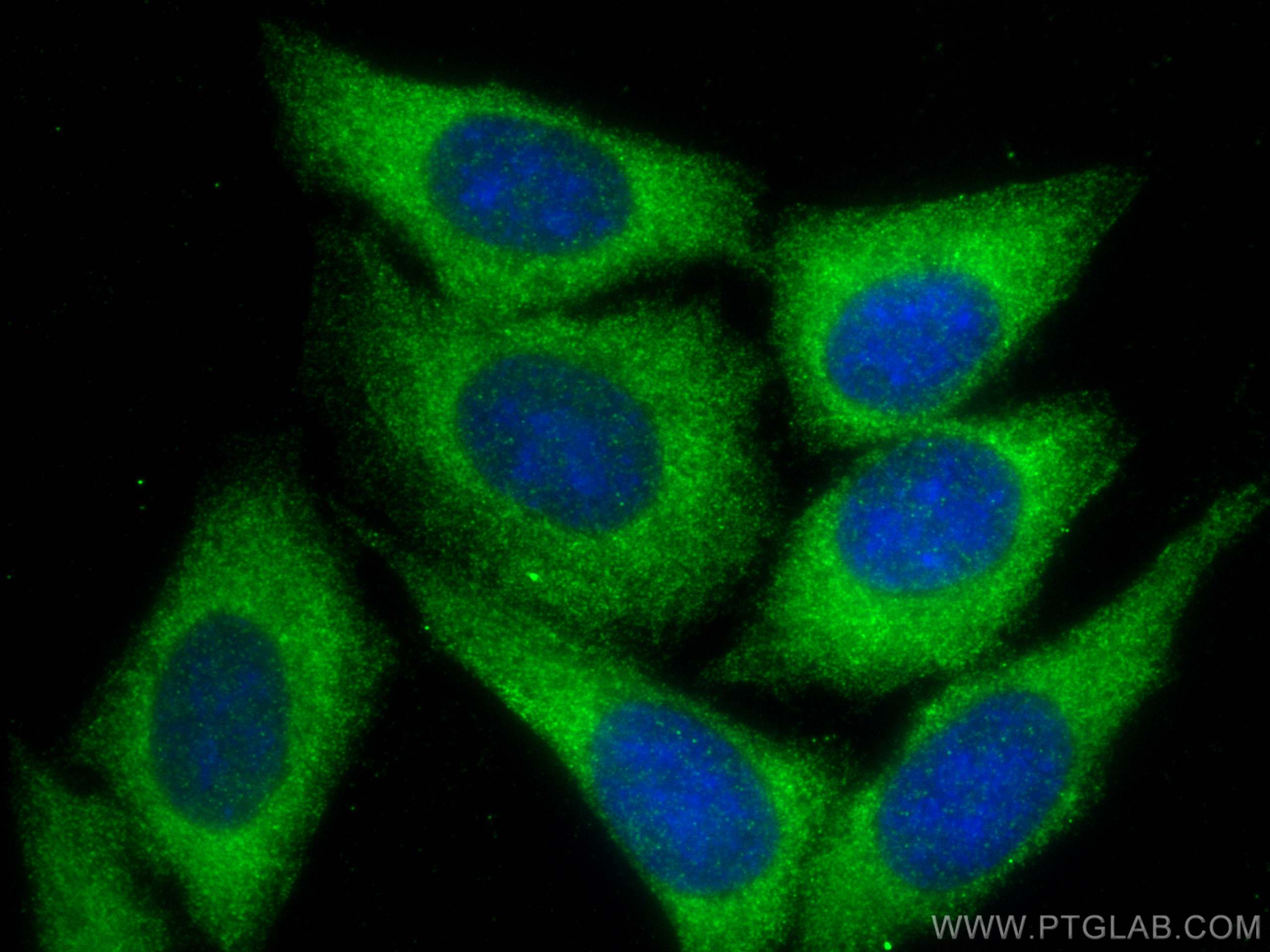 Immunofluorescence (IF) / fluorescent staining of HepG2 cells using KHK Polyclonal antibody (15681-1-AP)