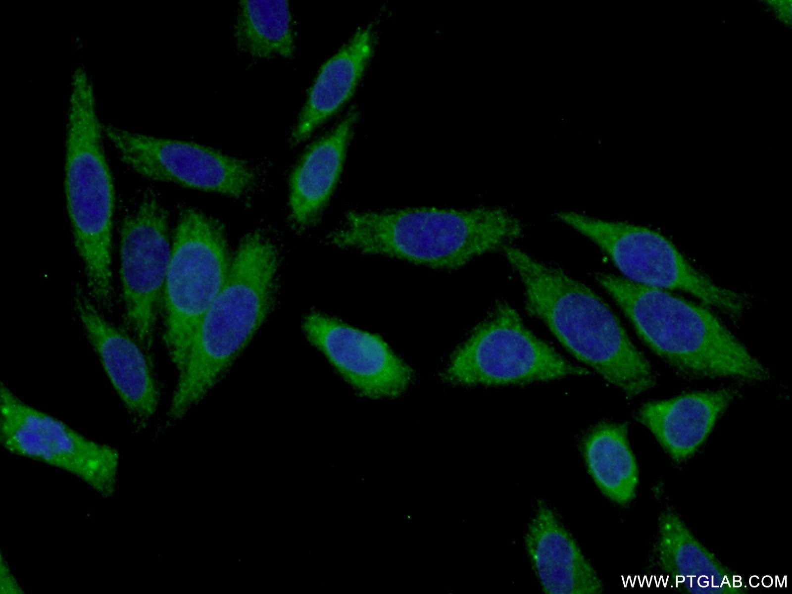 Immunofluorescence (IF) / fluorescent staining of HepG2 cells using KHK Polyclonal antibody (15681-1-AP)