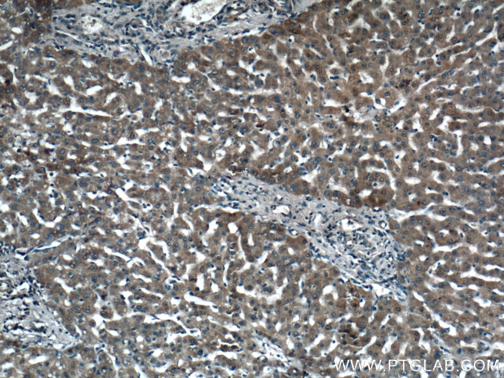 Immunohistochemistry (IHC) staining of human liver tissue using KHK Polyclonal antibody (15681-1-AP)