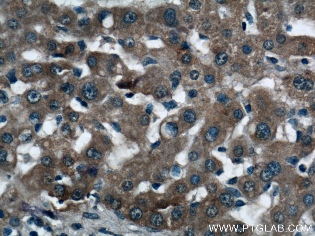 Immunohistochemistry (IHC) staining of human liver tissue using KHK Polyclonal antibody (15681-1-AP)