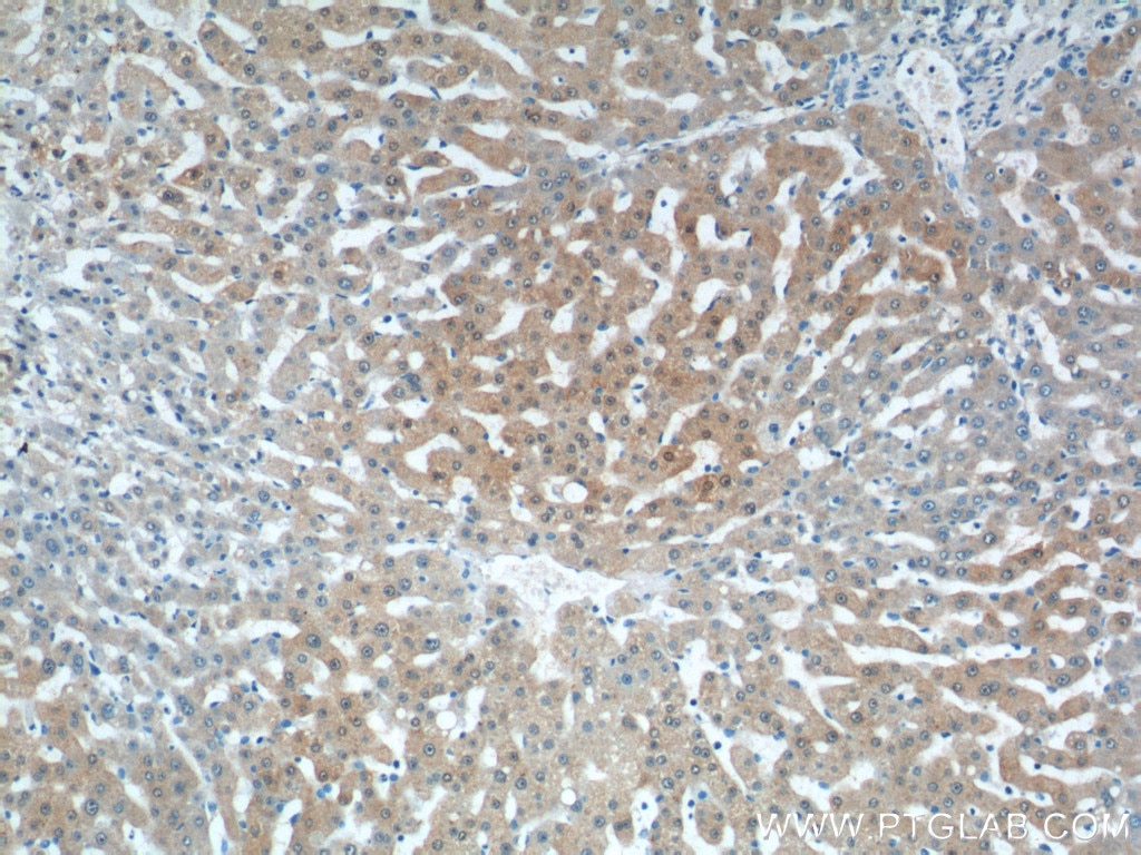 IHC staining of human liver using 15681-1-AP