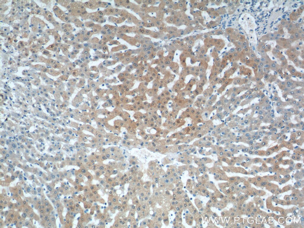 Immunohistochemistry (IHC) staining of human liver tissue using KHK Polyclonal antibody (15681-1-AP)