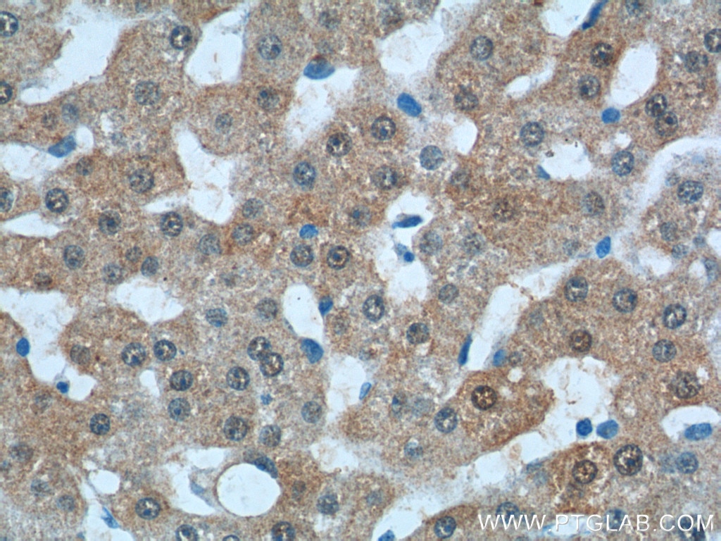 Immunohistochemistry (IHC) staining of human liver tissue using KHK Polyclonal antibody (15681-1-AP)