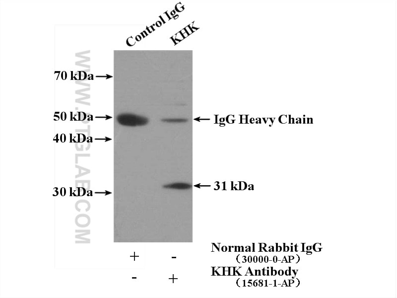 Immunoprecipitation (IP) experiment of mouse liver tissue using KHK Polyclonal antibody (15681-1-AP)