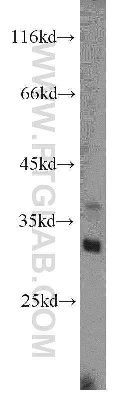 Western Blot (WB) analysis of human liver tissue using KHK Polyclonal antibody (15681-1-AP)