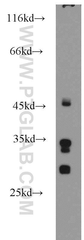 Western Blot (WB) analysis of mouse liver tissue using KHK Polyclonal antibody (15681-1-AP)
