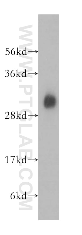 Western Blot (WB) analysis of human liver tissue using KHK Polyclonal antibody (15681-1-AP)