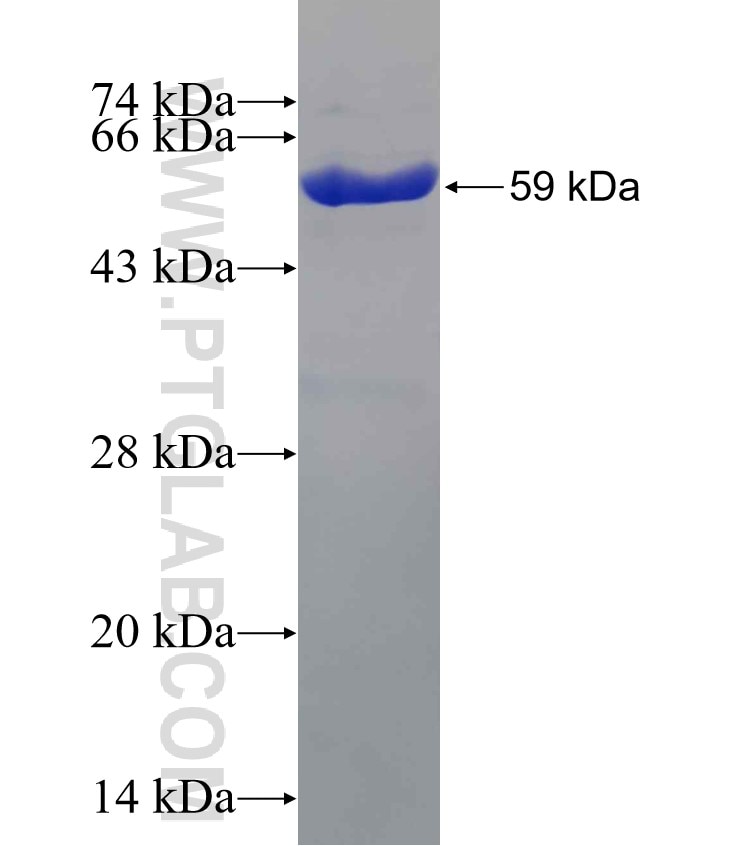 KHK fusion protein Ag8182 SDS-PAGE