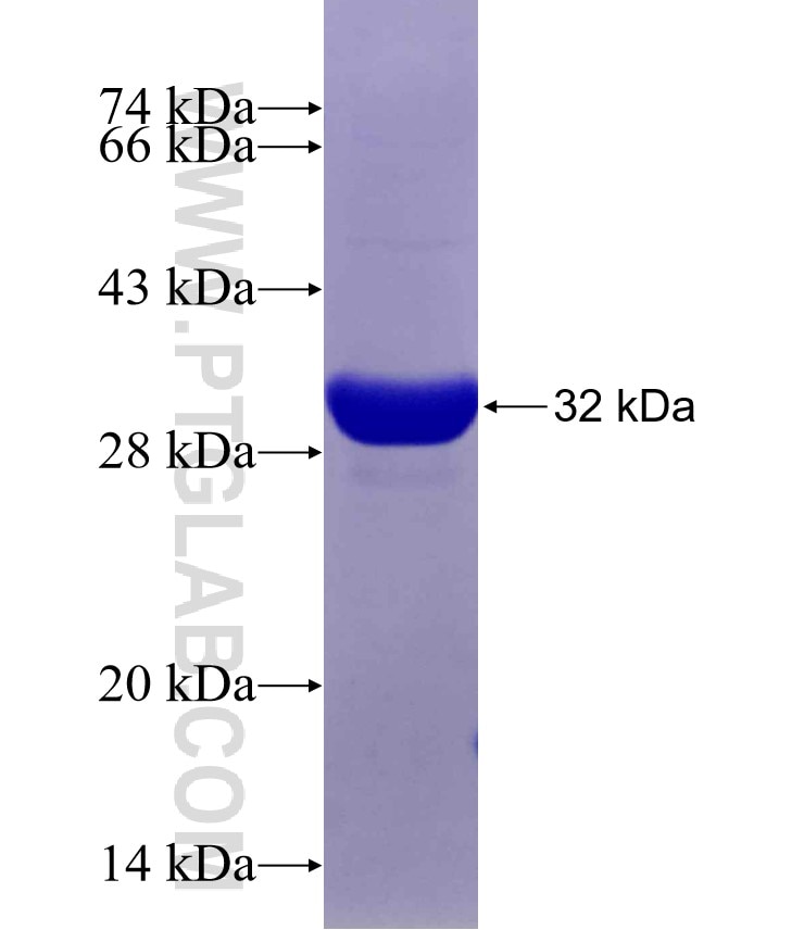 KHK fusion protein Ag8205 SDS-PAGE