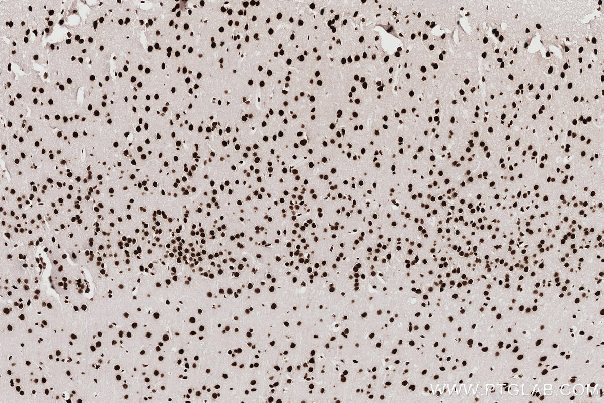 Immunohistochemistry (IHC) staining of mouse brain tissue using KHSRP Recombinant monoclonal antibody (82931-5-RR)