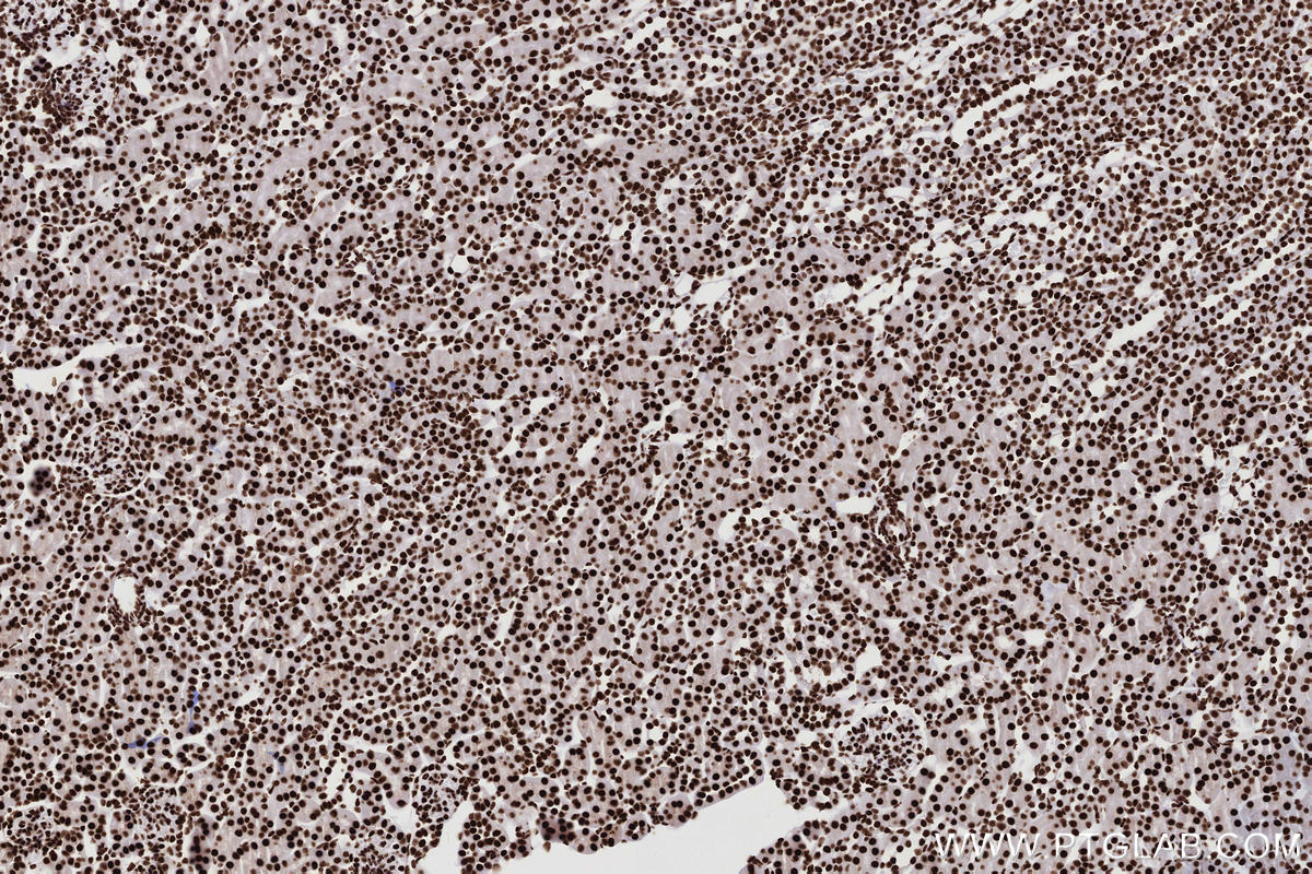 Immunohistochemistry (IHC) staining of mouse kidney tissue using KHSRP Recombinant monoclonal antibody (82931-5-RR)