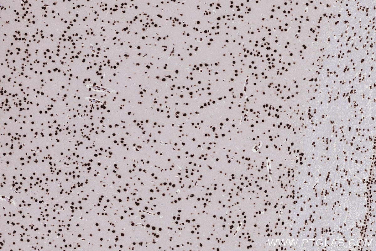 Immunohistochemistry (IHC) staining of rat brain tissue using KHSRP Recombinant monoclonal antibody (82931-5-RR)