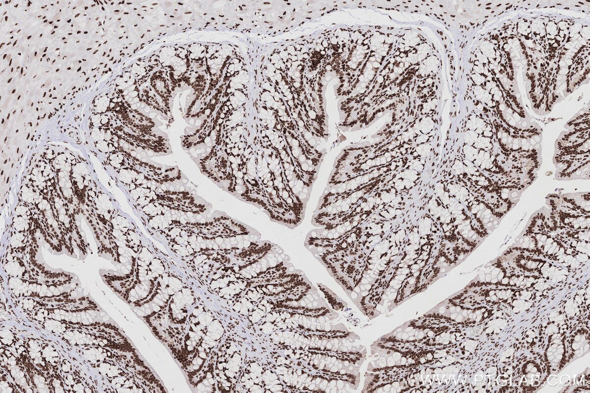 Immunohistochemistry (IHC) staining of rat colon tissue using KHSRP Recombinant monoclonal antibody (82931-5-RR)