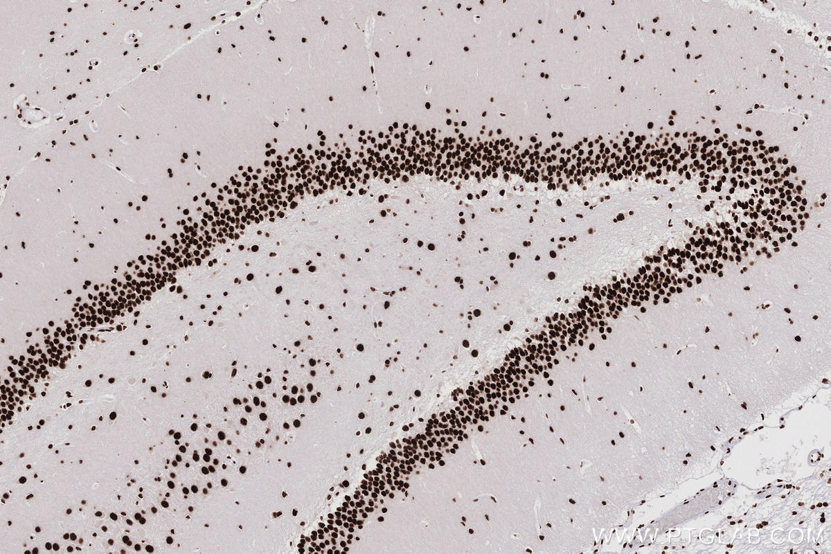 Immunohistochemistry (IHC) staining of rat brain tissue using KHSRP Recombinant monoclonal antibody (82931-5-RR)
