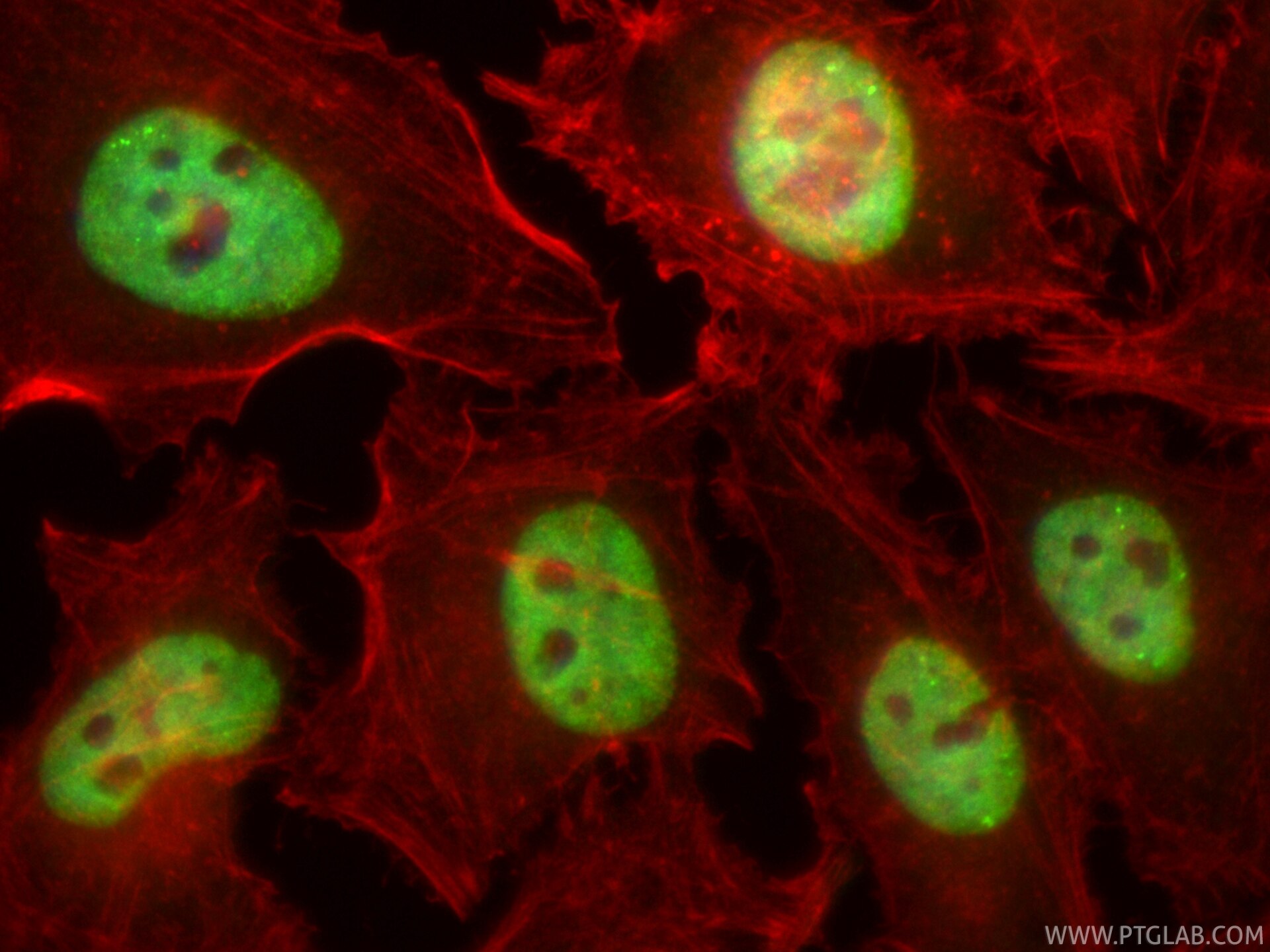 Immunofluorescent analysis of (4% PFA) fixed HeLa cells using CoraLite® Plus 488 KHSRP antibody (CL488-82931, Clone: 230189G1 ) at dilution of 1:200, CL594-phalloidin (red). Immunofluorescence (IF) / fluorescent staining of HeLa cells using CoraLite® Plus 488-conjugated KHSRP Recombinant mo (CL488-82931)