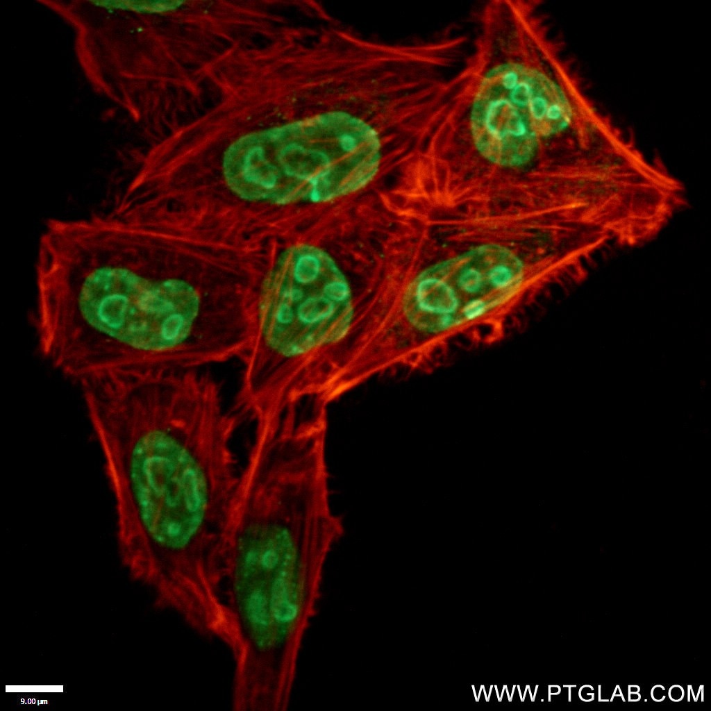 Immunofluorescence (IF) / fluorescent staining of HeLa cells using KI67 Polyclonal antibody (27309-1-AP)