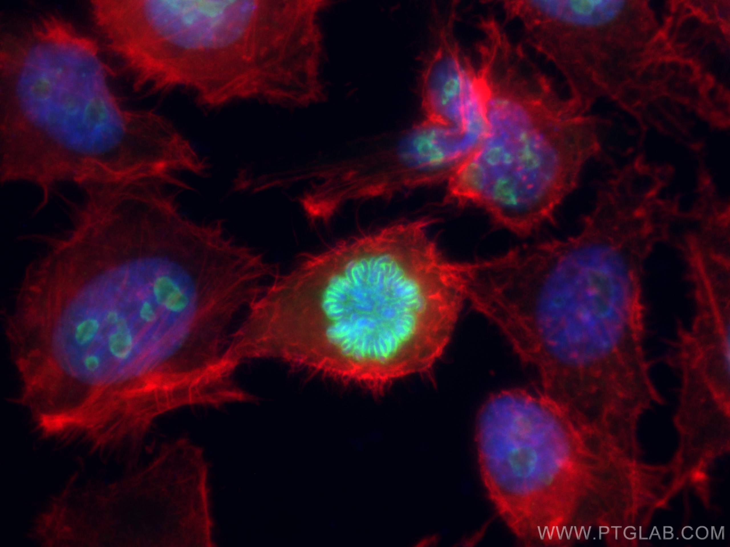 Immunofluorescence (IF) / fluorescent staining of HeLa cells using KI67 Polyclonal antibody (27309-1-AP)