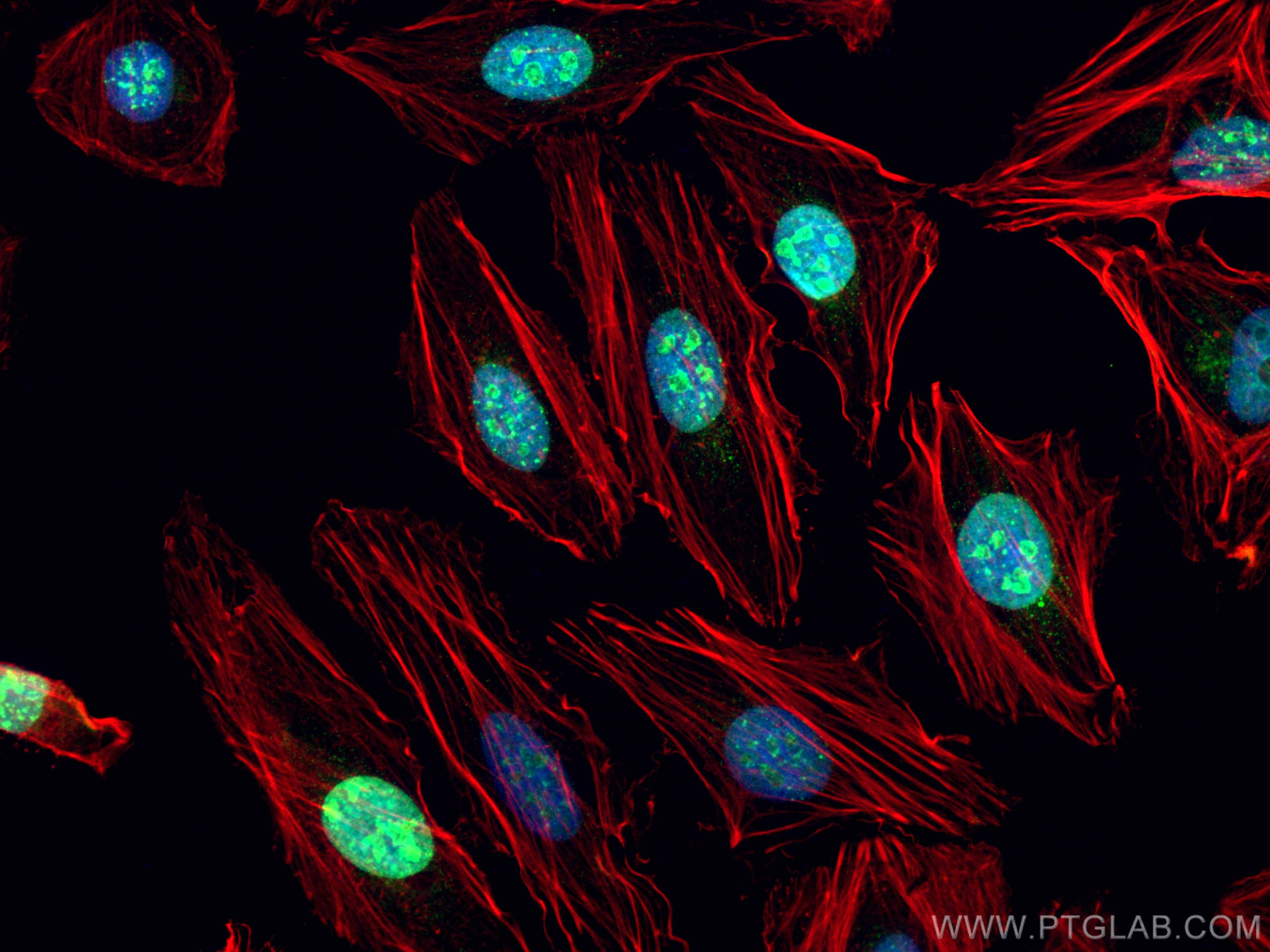 Immunofluorescence (IF) / fluorescent staining of HeLa cells using KI67 Polyclonal antibody (27309-1-AP)