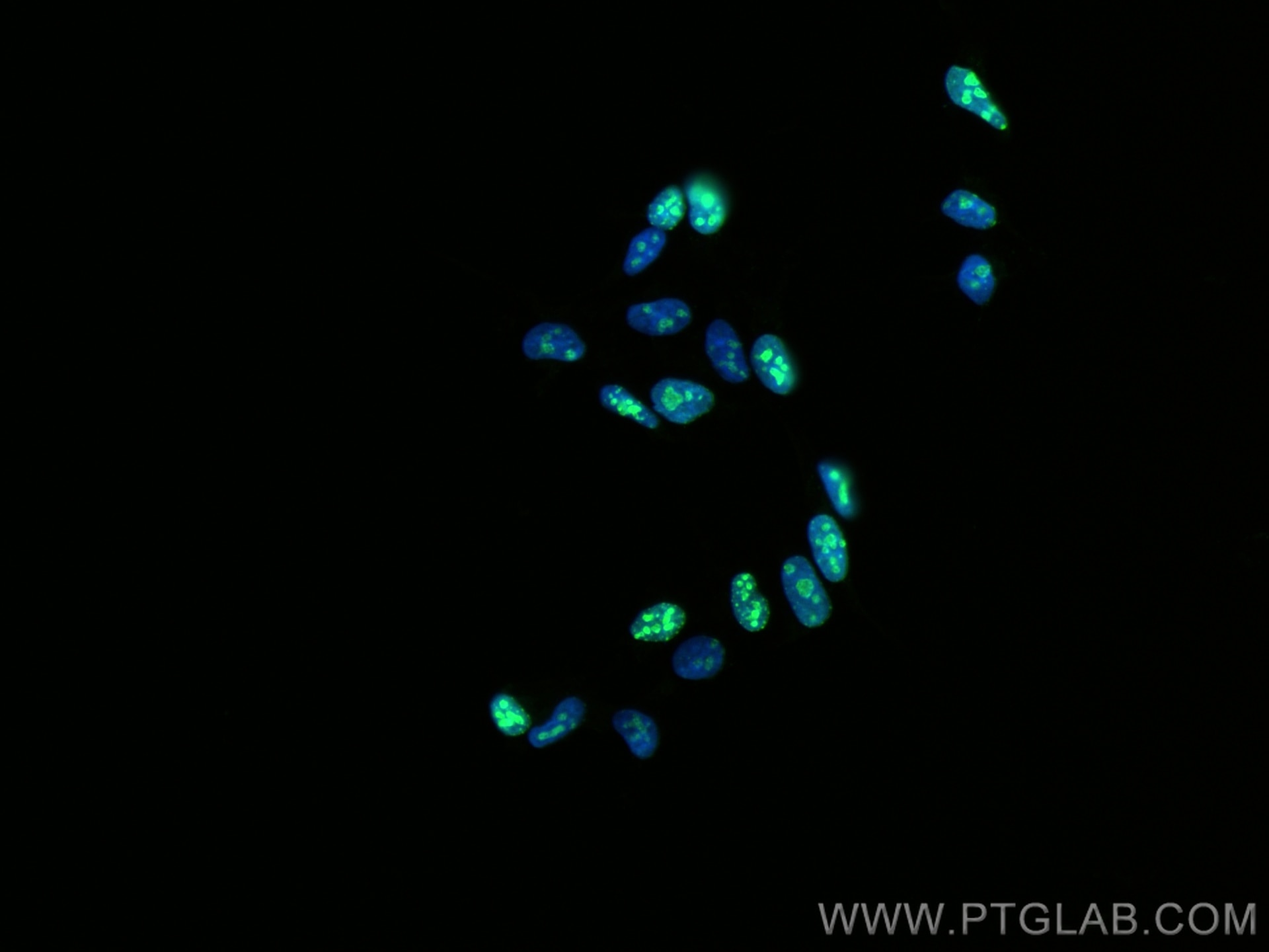 Immunofluorescence (IF) / fluorescent staining of HEK-293 cells using KI67 Polyclonal antibody (27309-1-AP)