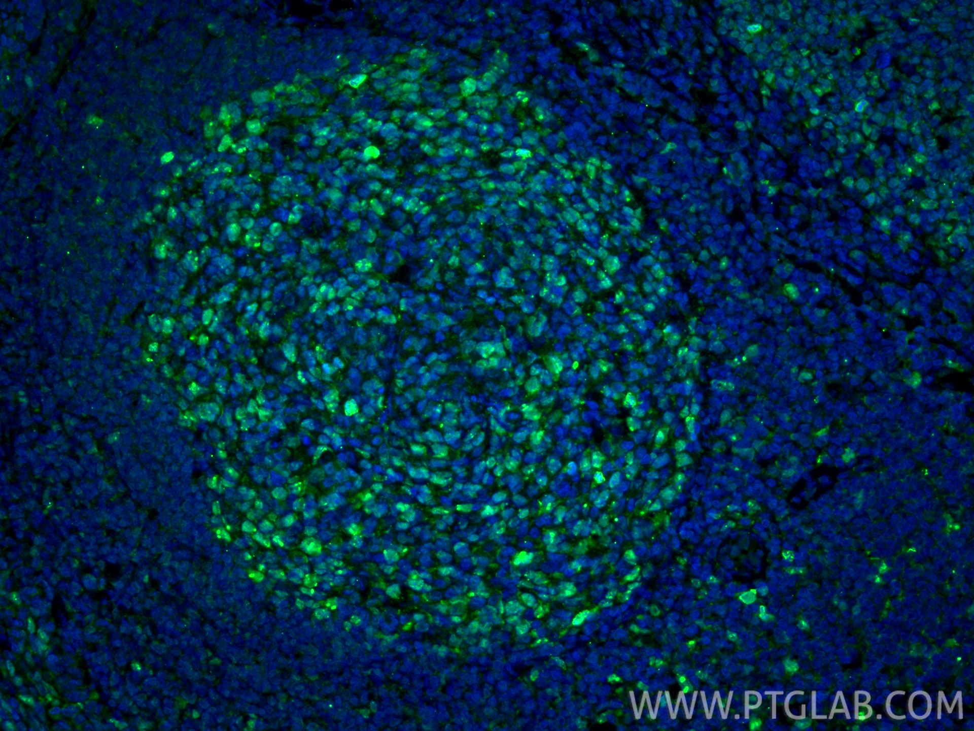 IF Staining of human tonsillitis using 27309-1-AP Immunofluorescence (IF) / fluorescent staining of human tonsillitis tissue using Ki-67 Polyclonal antibody (27309-1-AP)