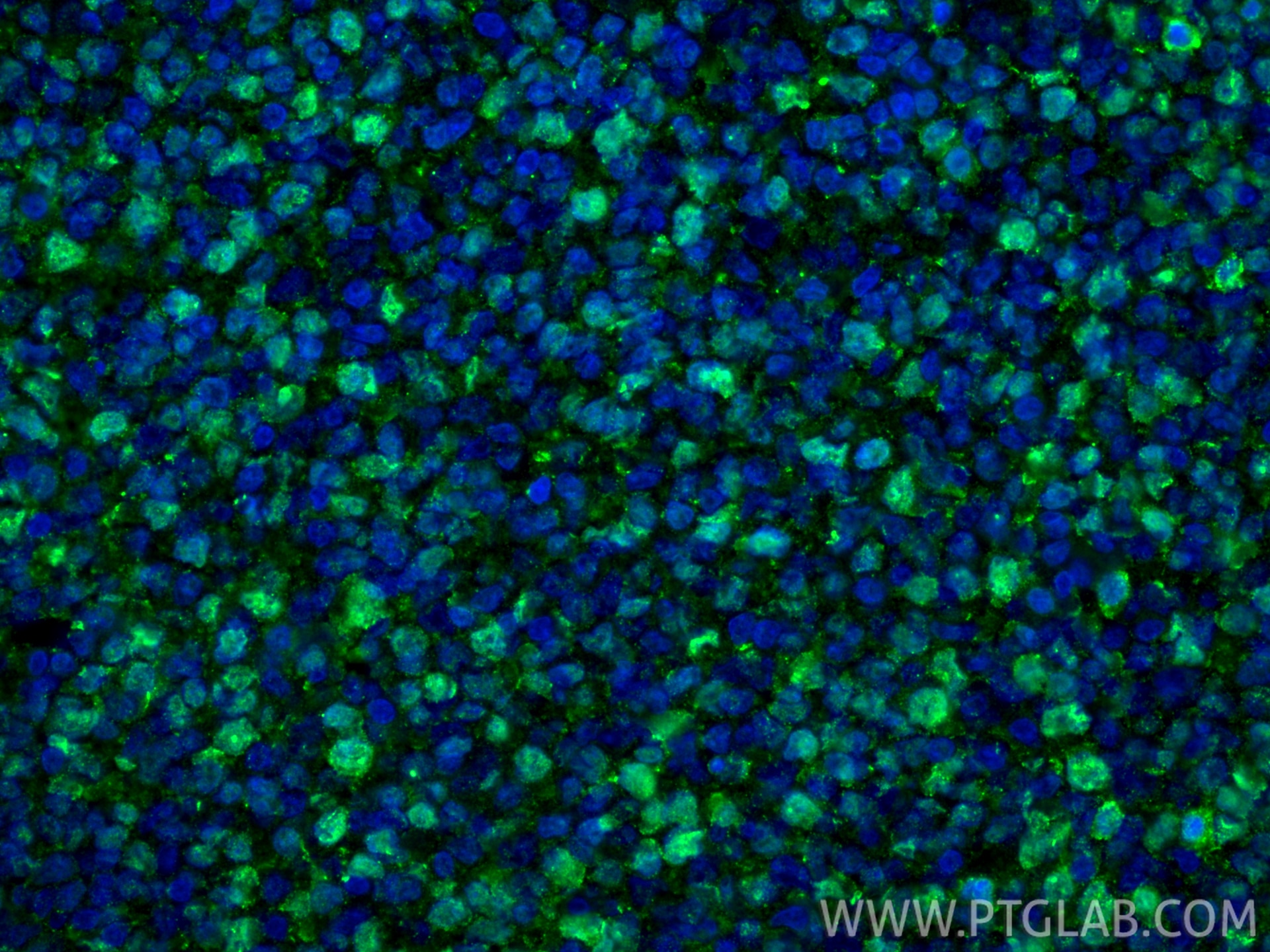 IF Staining of human tonsillitis using 27309-1-AP Immunofluorescence (IF) / fluorescent staining of human tonsillitis tissue using Ki-67 Polyclonal antibody (27309-1-AP)