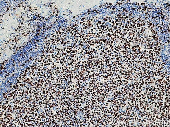 KI67ポリクローナル抗体を使用したヒト扁桃炎組織の免疫組織化学染色