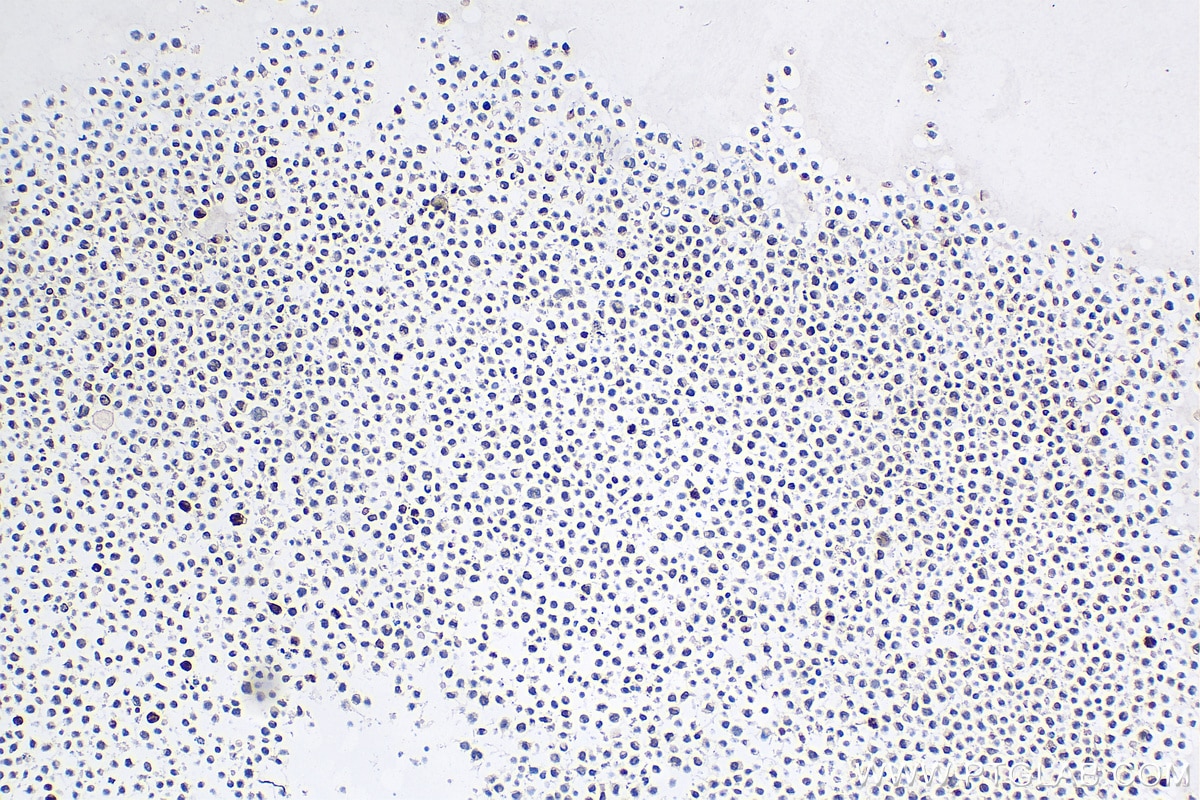 Immunohistochemistry (IHC) staining of K-562 cells using KI67 Polyclonal antibody (27309-1-AP)