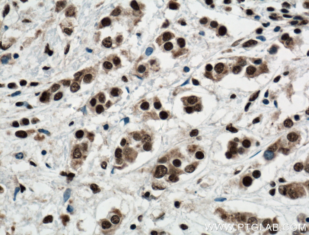 KI67 Polyclonal antibody