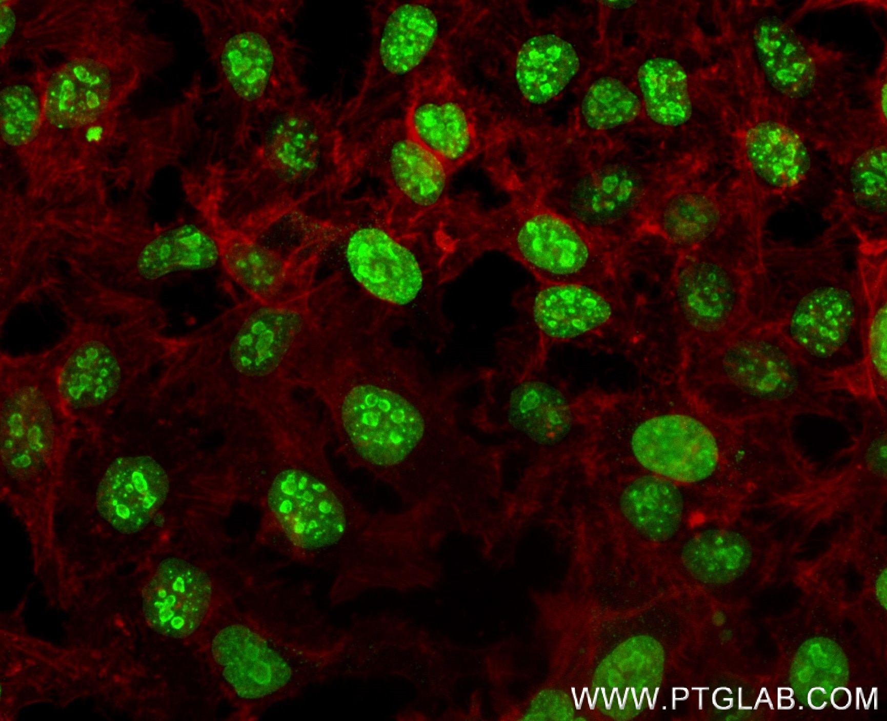 Immunofluorescence (IF) / fluorescent staining of HeLa cells using Ki-67 Recombinant monoclonal antibody (84192-3-RR)