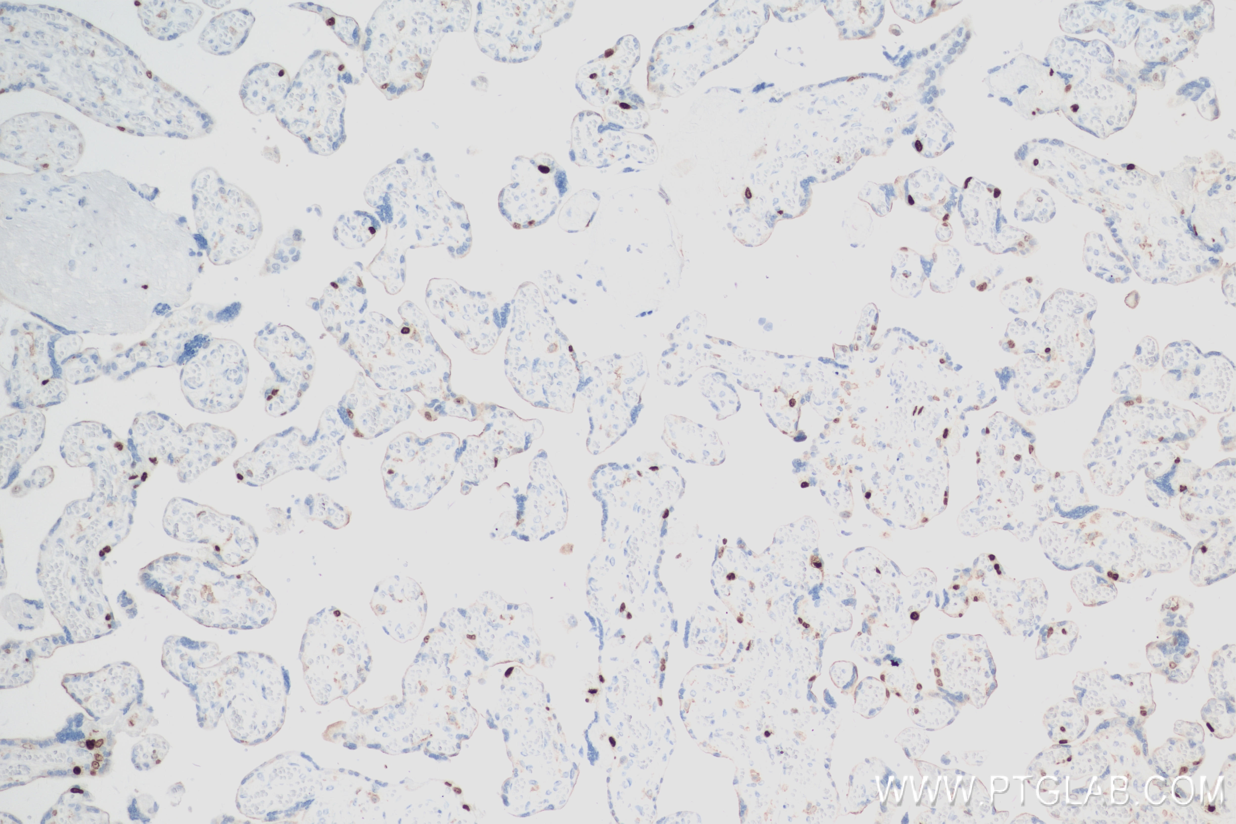Immunohistochemistry (IHC) staining of human placenta tissue using KI67 Recombinant antibody (84192-3-RR)