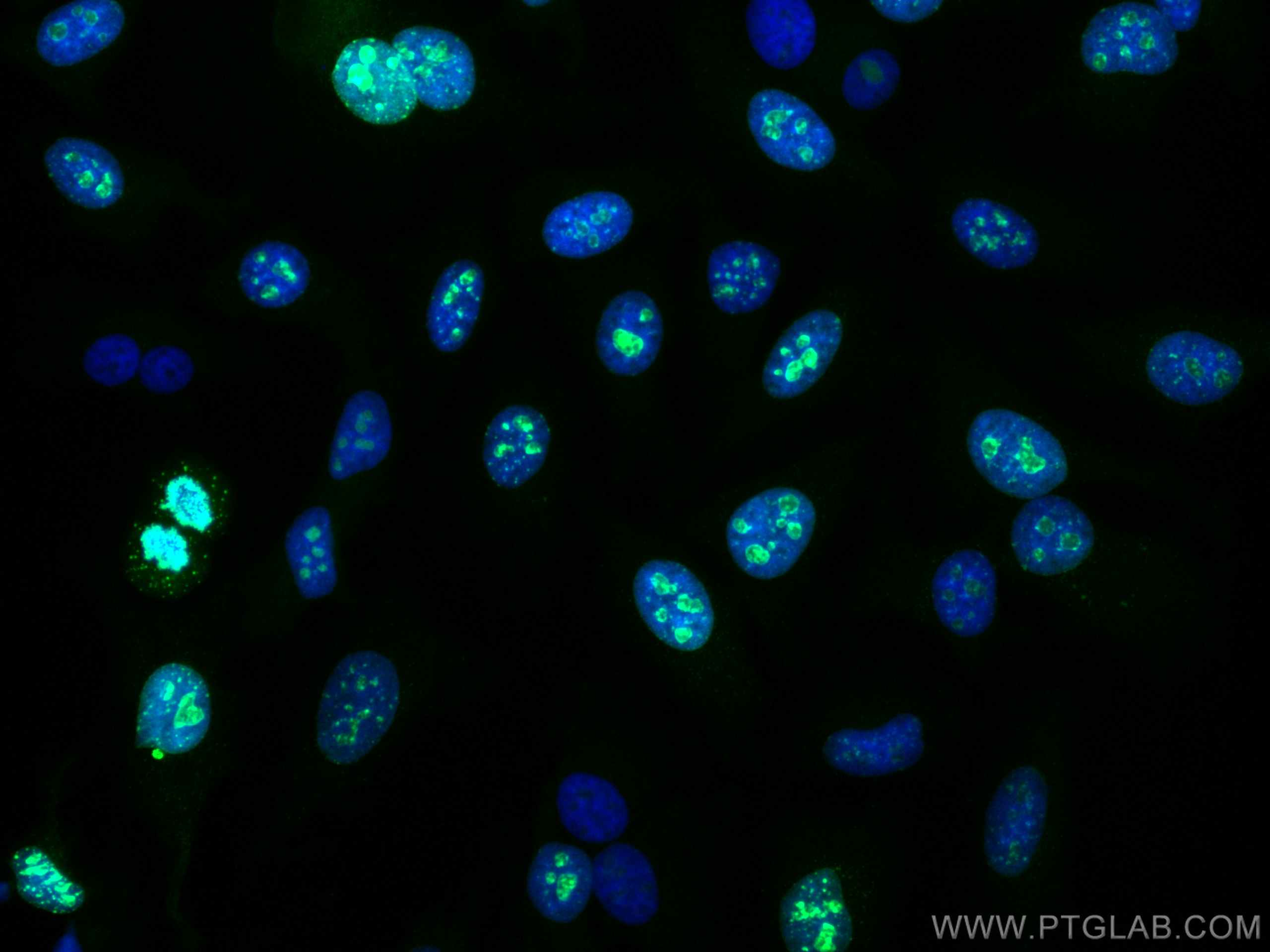 Immunofluorescence (IF) / fluorescent staining of HeLa cells using CoraLite® Plus 488-conjugated KI67 Polyclonal anti (CL488-27309)