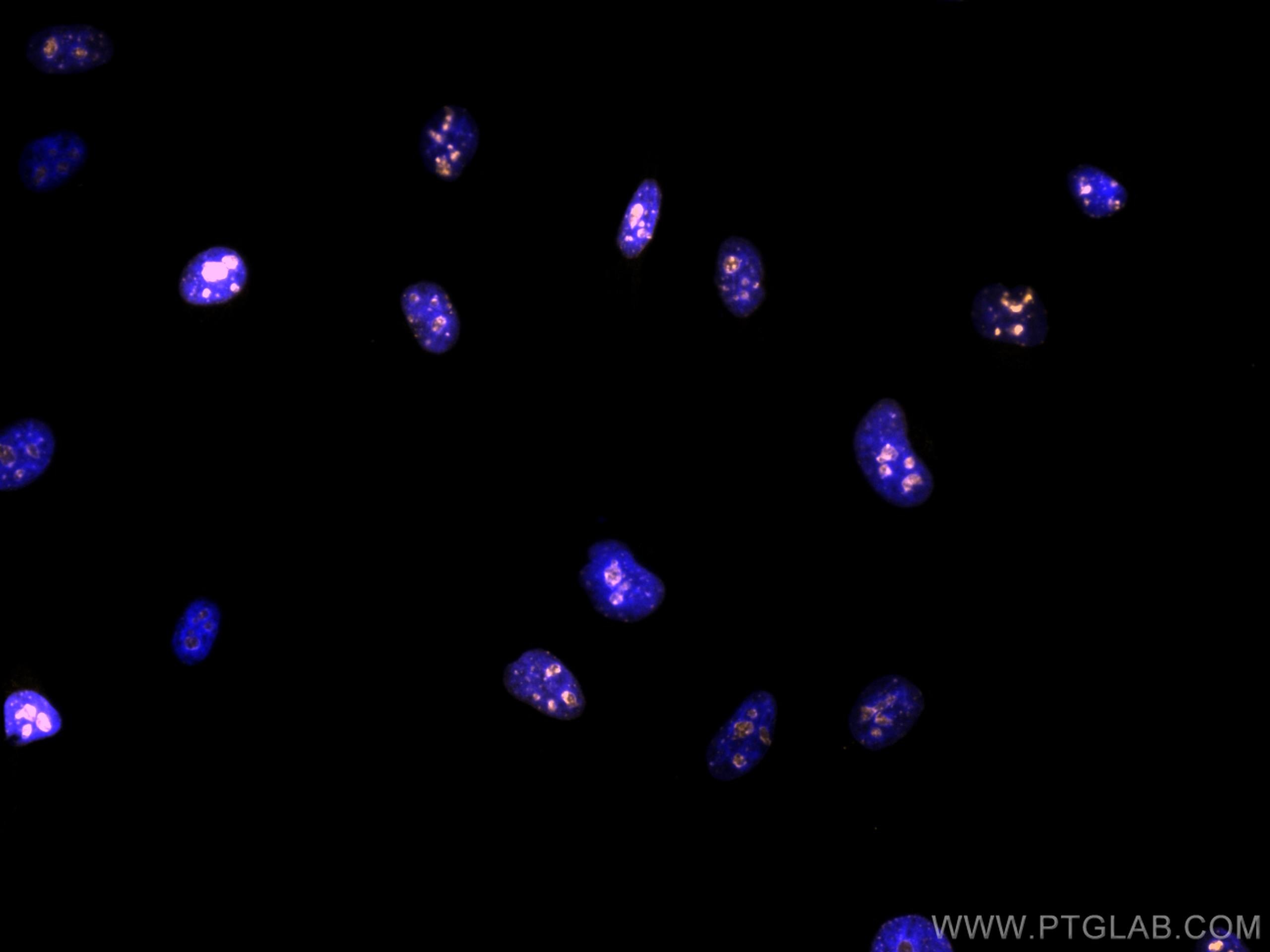 Immunofluorescence (IF) / fluorescent staining of HeLa cells using CoraLite®555-conjugated KI67 Polyclonal antibody (CL555-27309)