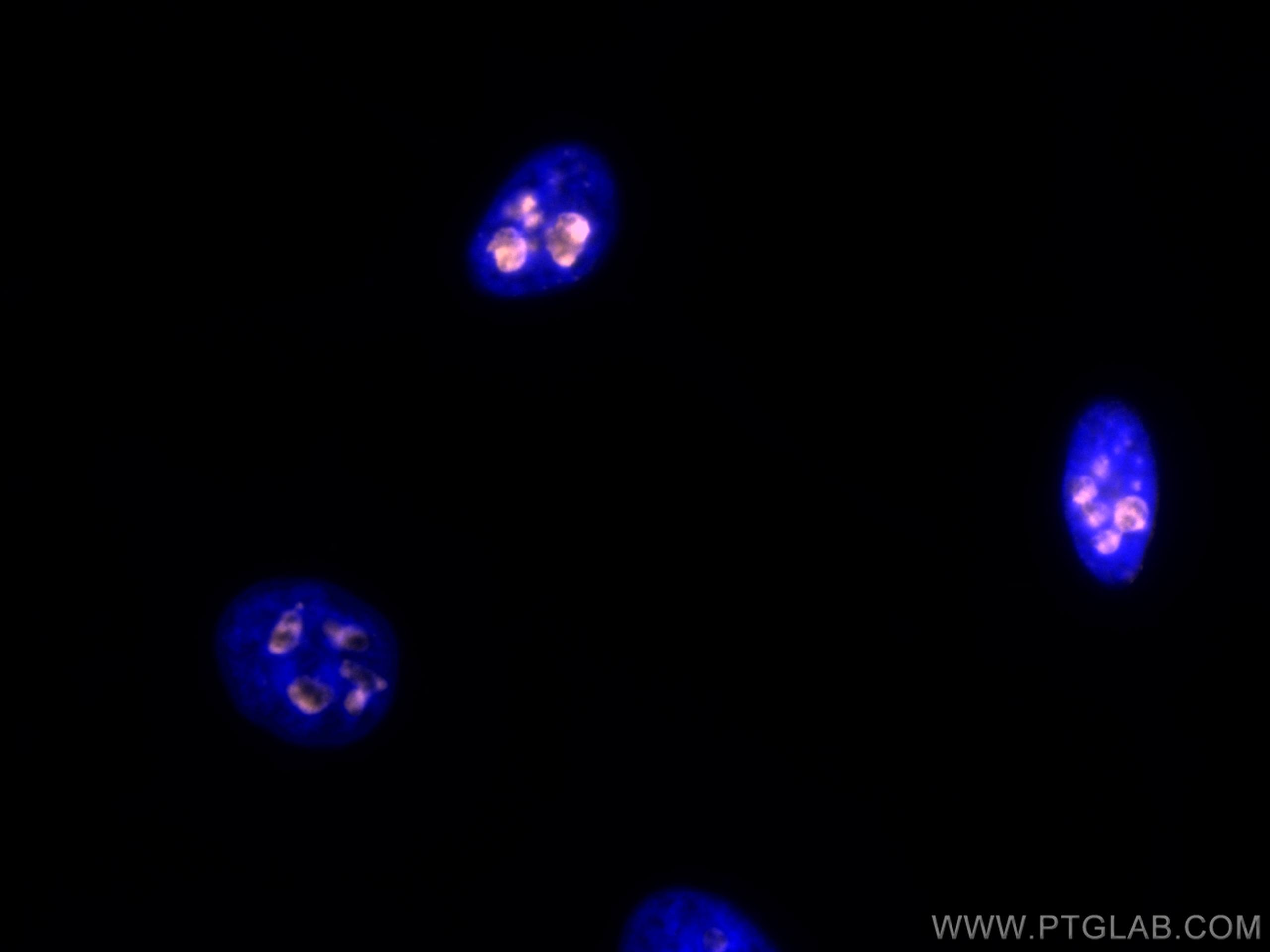 Immunofluorescence (IF) / fluorescent staining of HeLa cells using CoraLite®555-conjugated KI67 Polyclonal antibody (CL555-27309)