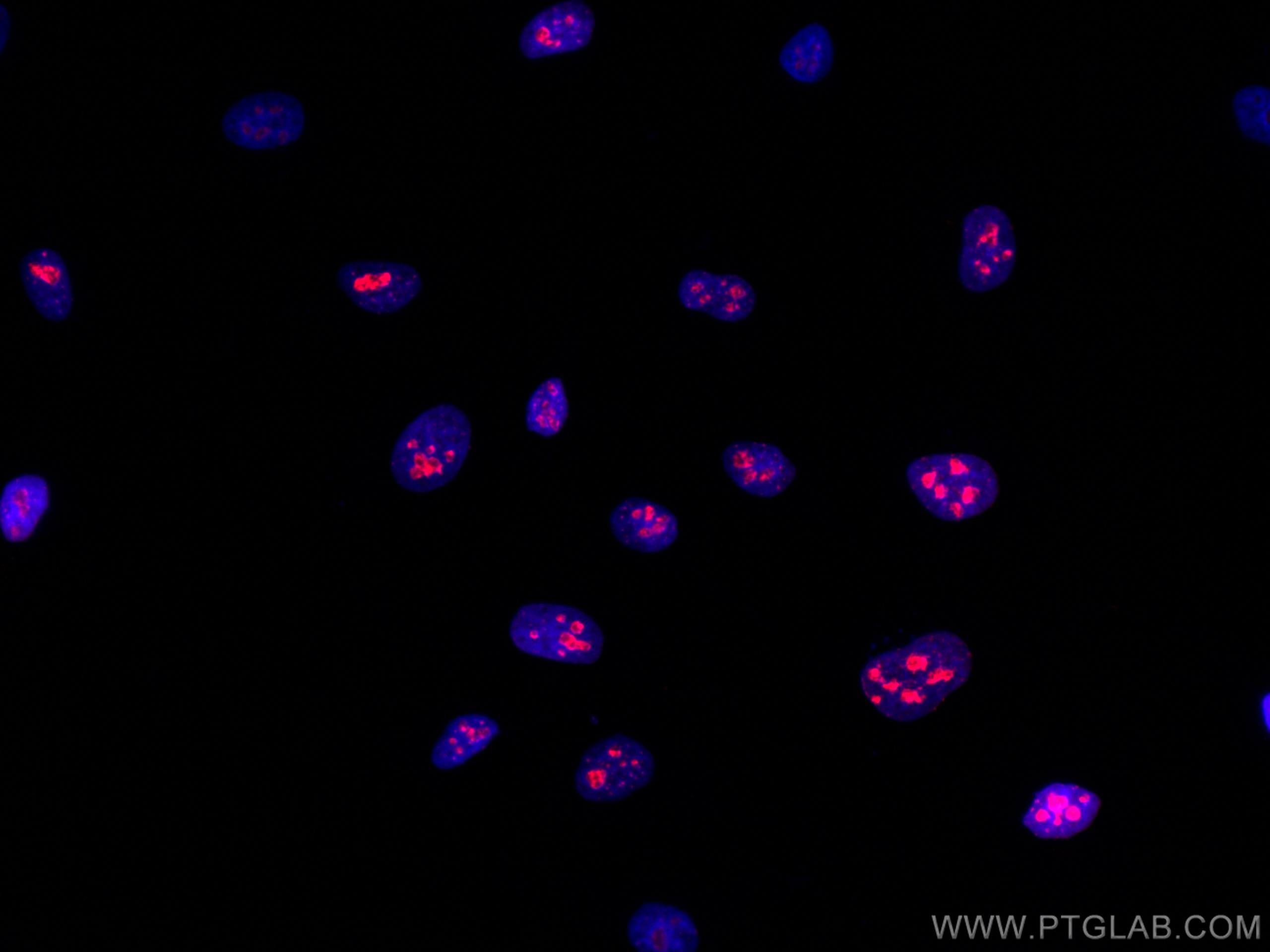 Immunofluorescence (IF) / fluorescent staining of HeLa cells using CoraLite®594-conjugated KI67 Polyclonal antibody (CL594-27309)