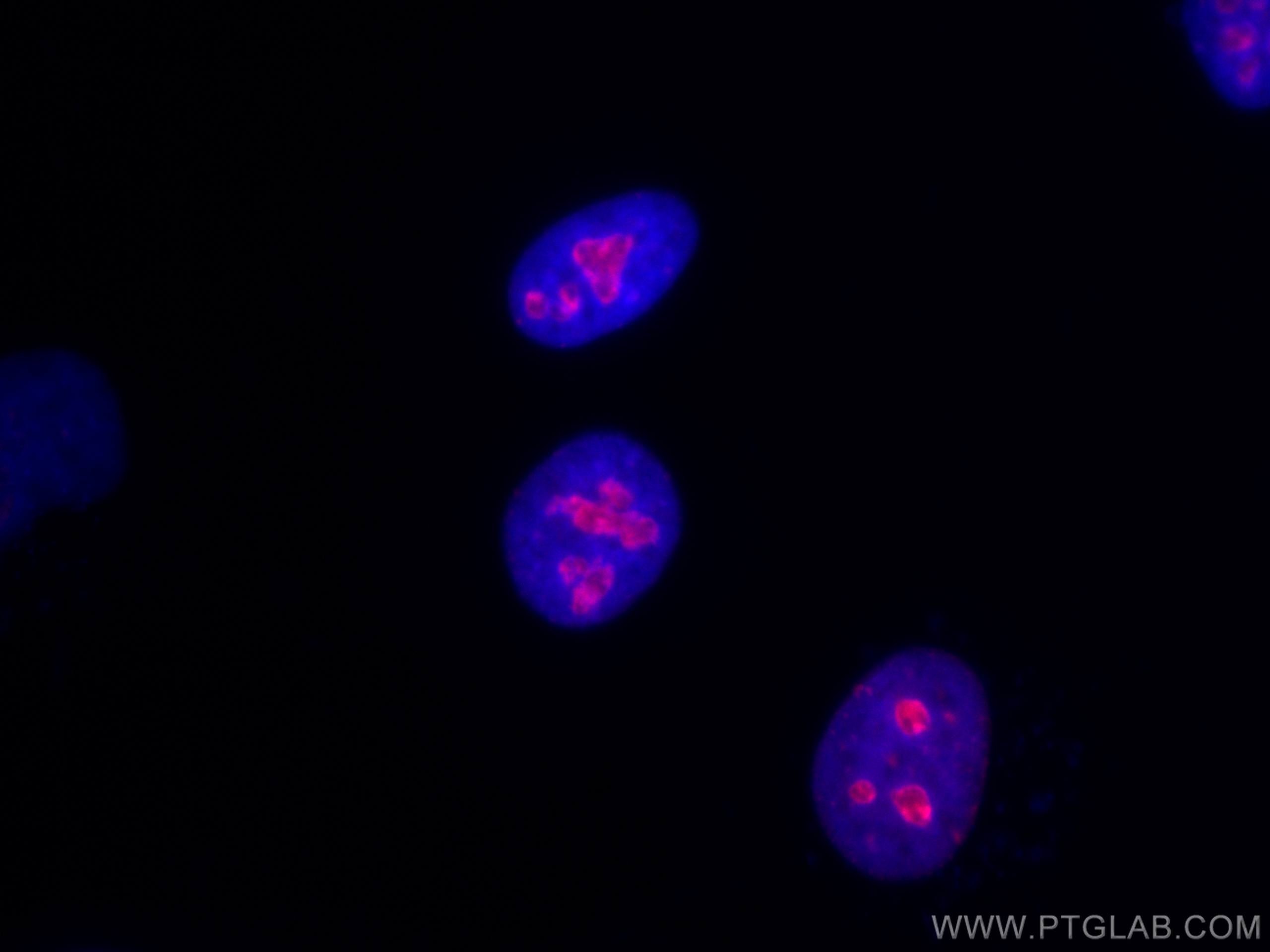 Immunofluorescence (IF) / fluorescent staining of HeLa cells using CoraLite®594-conjugated KI67 Polyclonal antibody (CL594-27309)