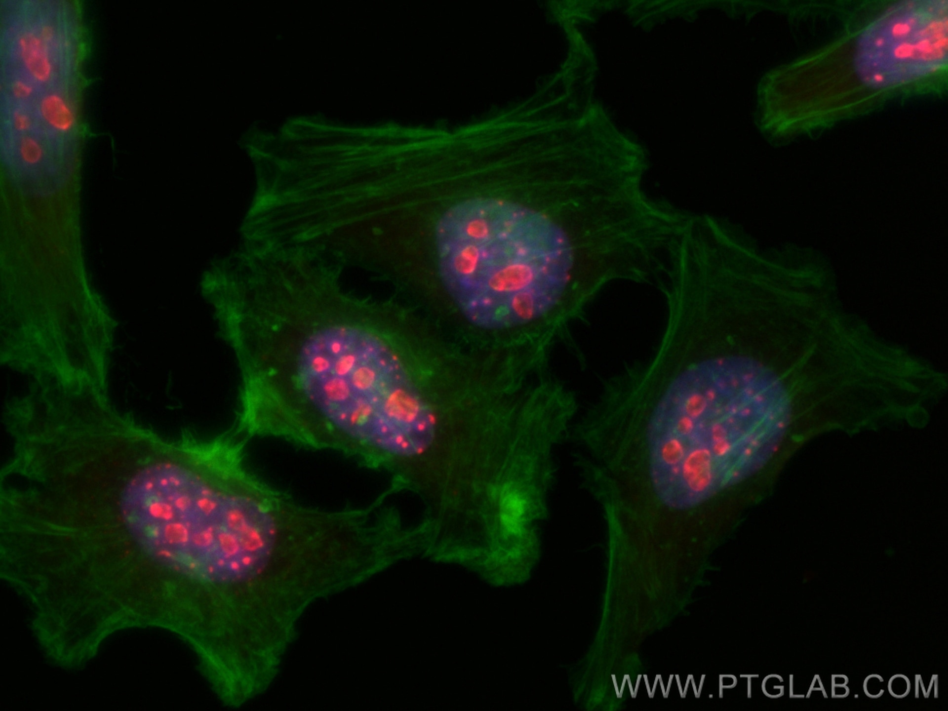 Immunofluorescence (IF) / fluorescent staining of HeLa cells using CoraLite®594-conjugated Ki-67 Polyclonal antibody (CL594-27309)