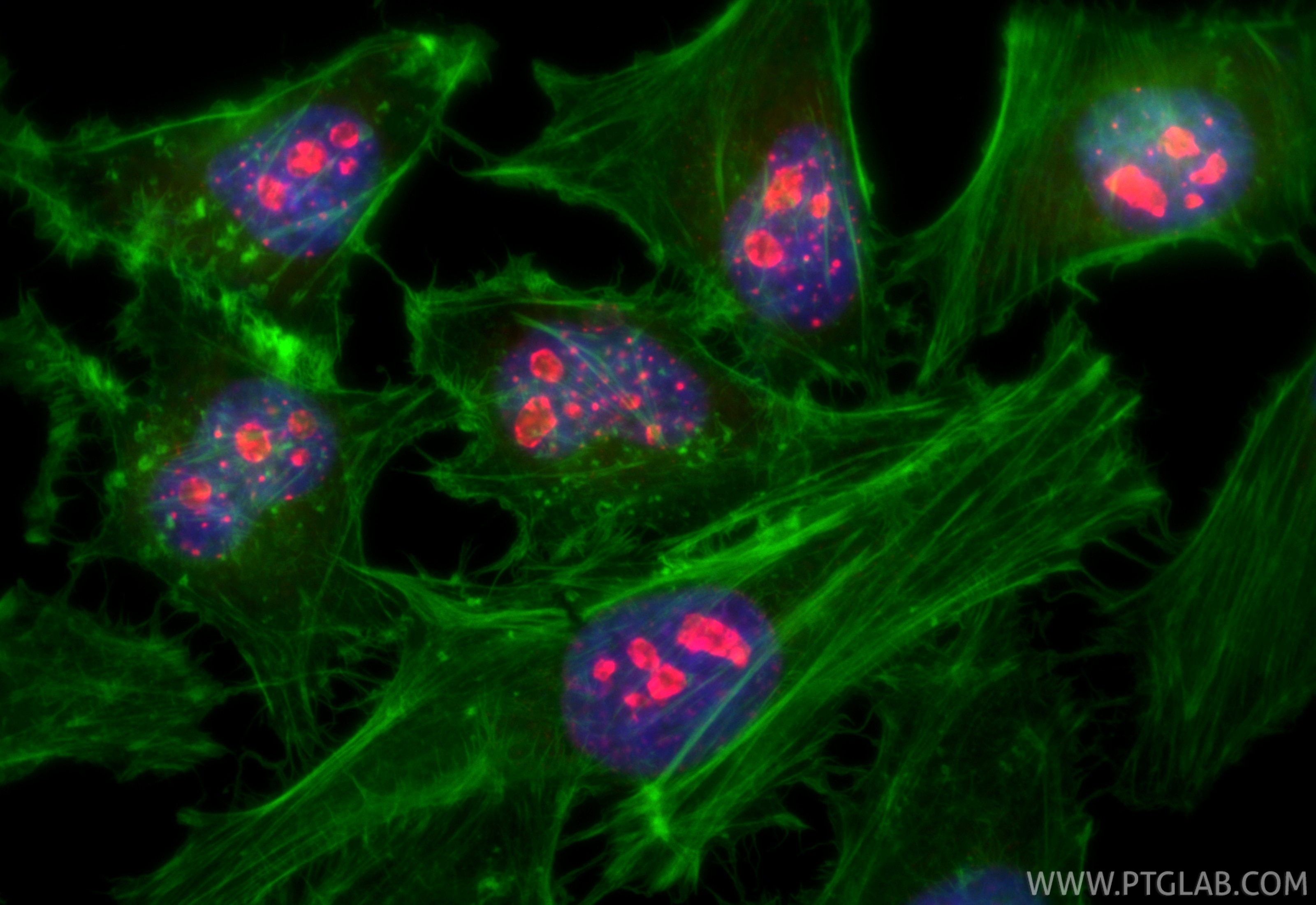 Immunofluorescence (IF) / fluorescent staining of HeLa cells using CoraLite®594-conjugated Ki-67 Polyclonal antibody (CL594-27309)
