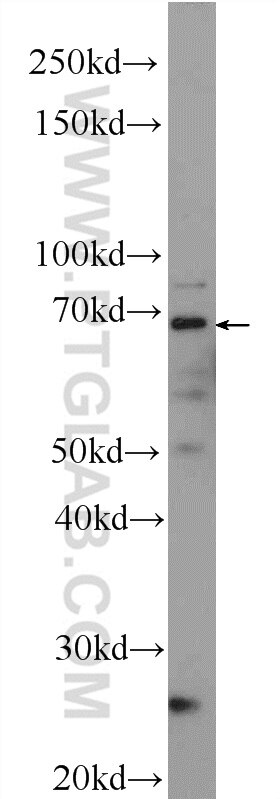 PUF-A,KIAA0020