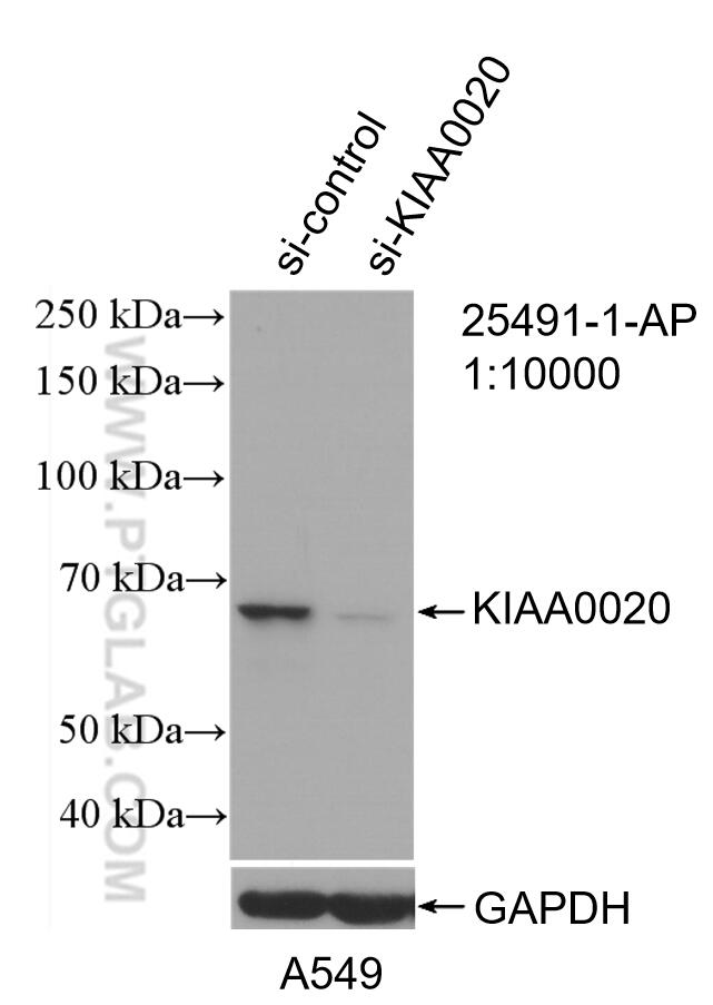 Western Blot (WB) analysis of A549 cells using PUF-A,KIAA0020 Polyclonal antibody (25491-1-AP)