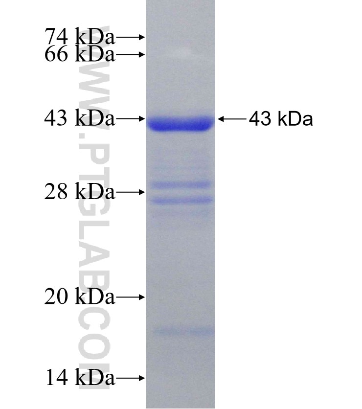 KIAA0020 fusion protein Ag31324 SDS-PAGE