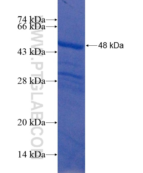 KIAA0020 fusion protein Ag22011 SDS-PAGE